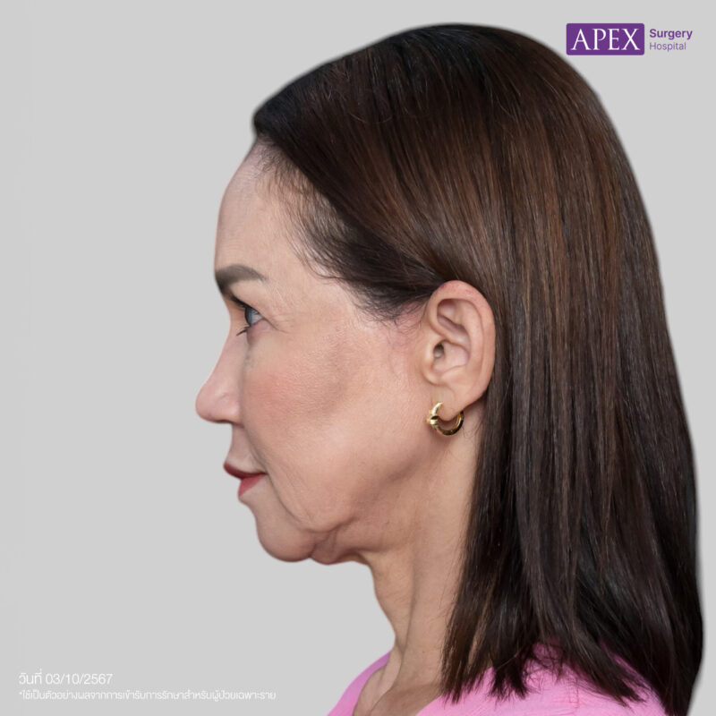 BA_Web_คุณดี้ ดึงหน้า-03