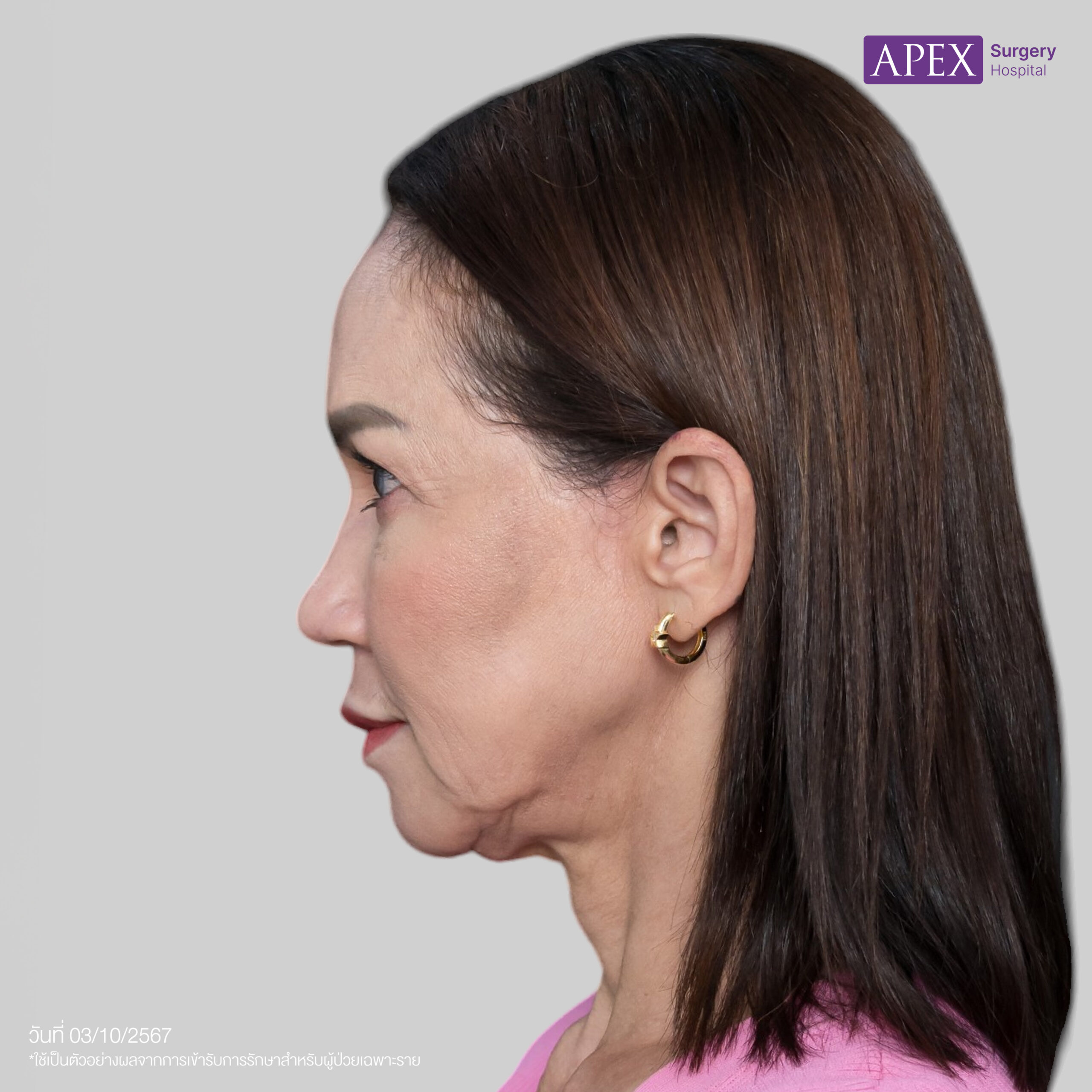 BA_Web_คุณดี้ ดึงหน้า-03