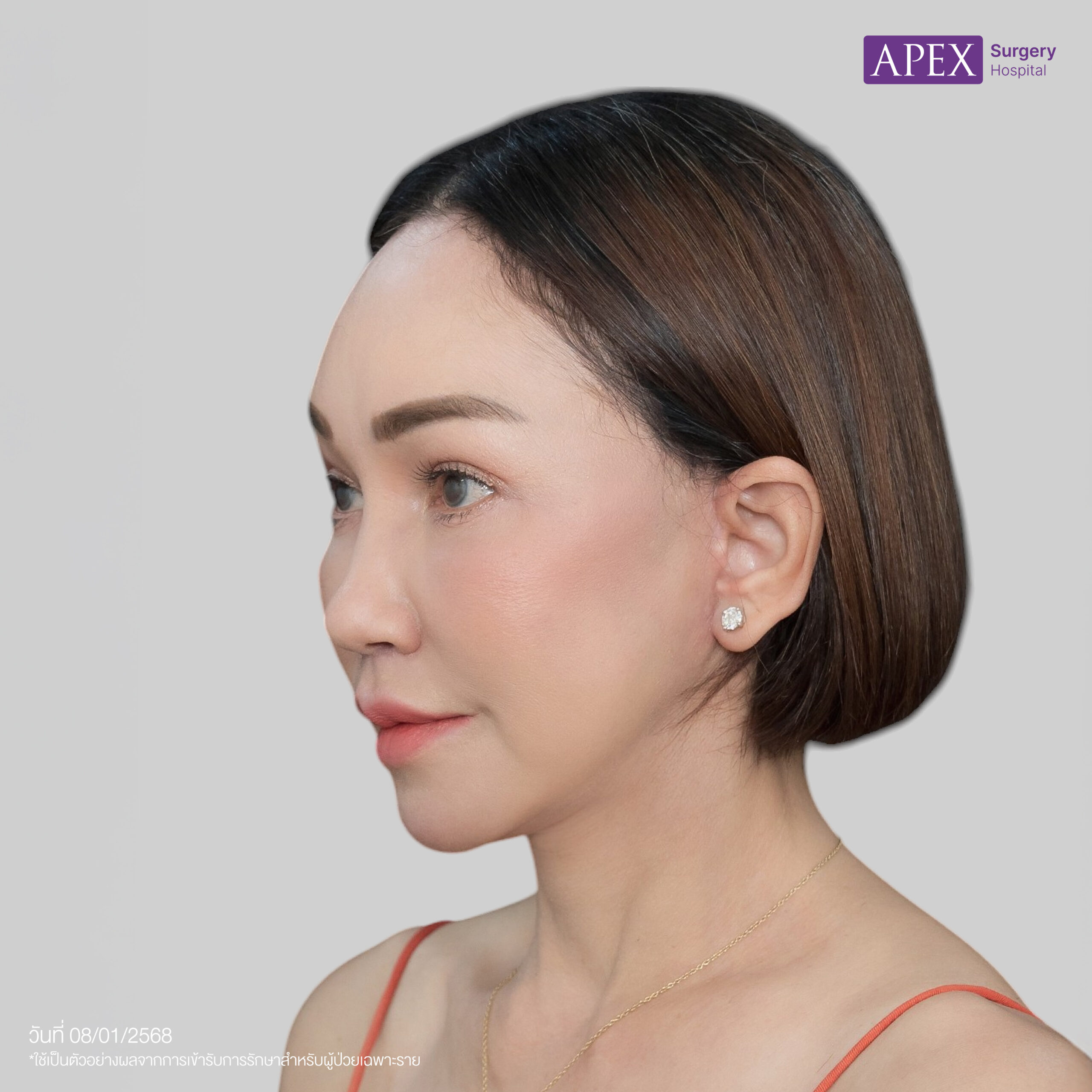 BA_Web_คุณดี้ ดึงหน้า-05