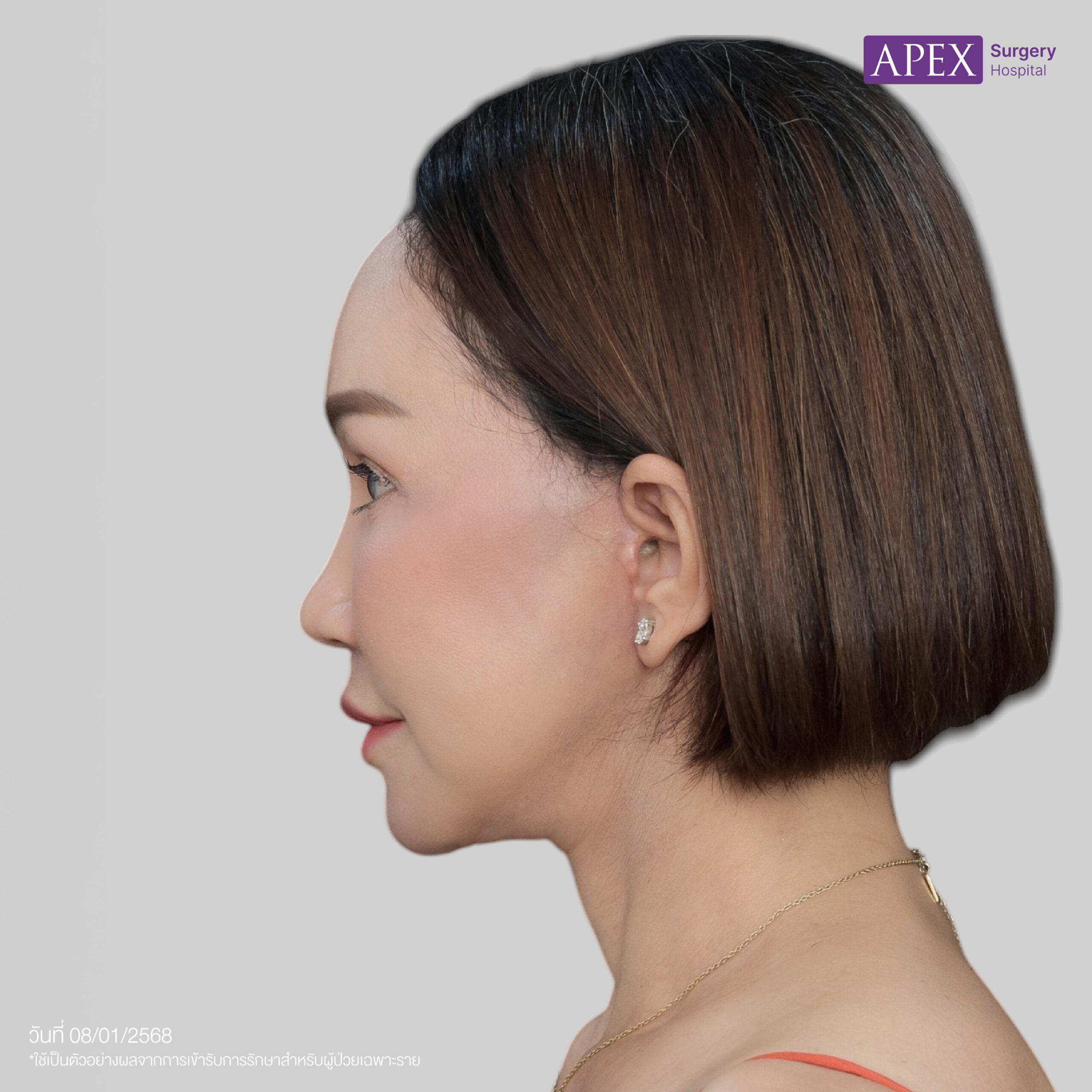 BA_Web_คุณดี้ ดึงหน้า-06