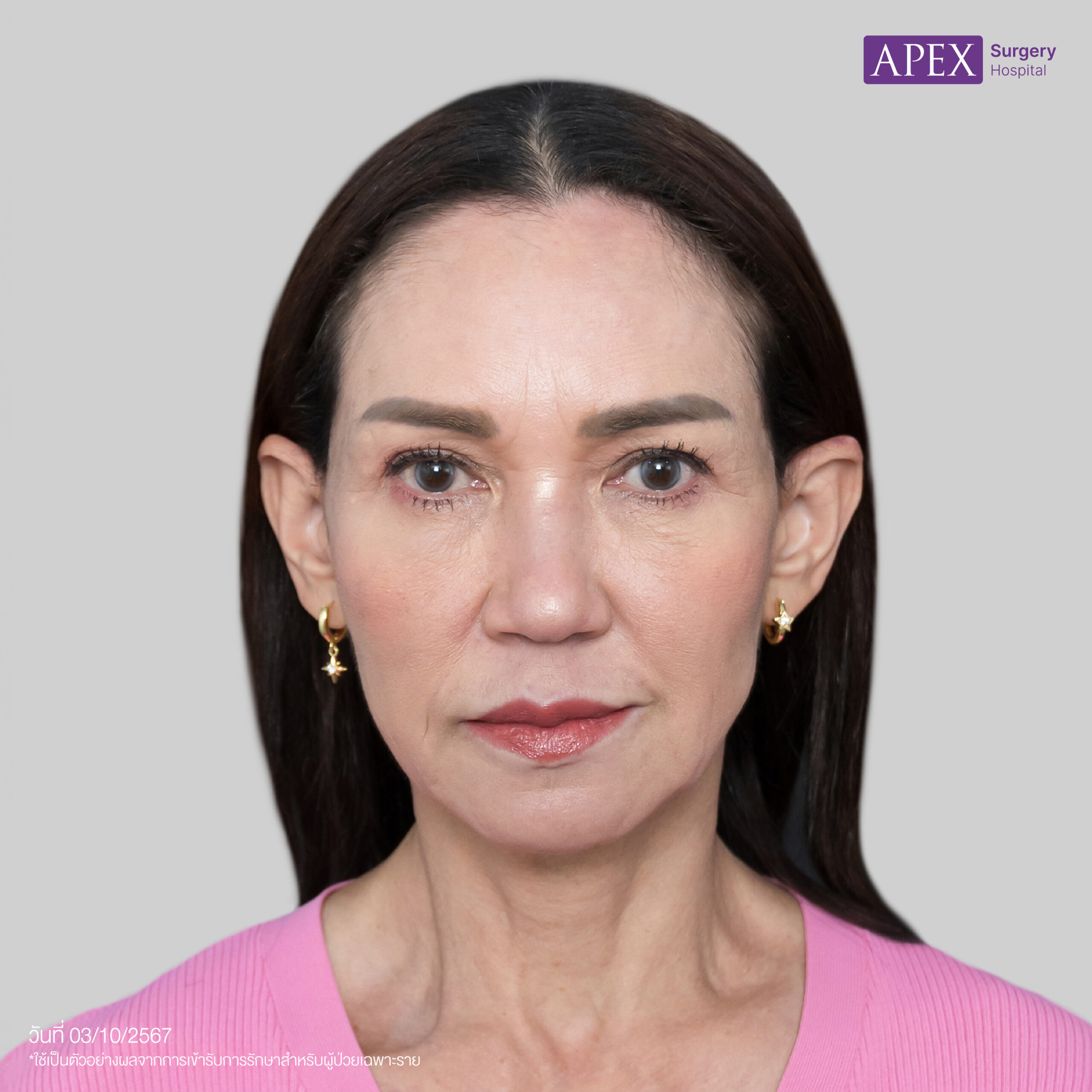 BA_Web_คุณดี้ ดึงหน้าn แก้-01