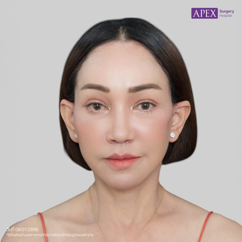 BA_Web_คุณดี้ ดึงหน้าn แก้-04
