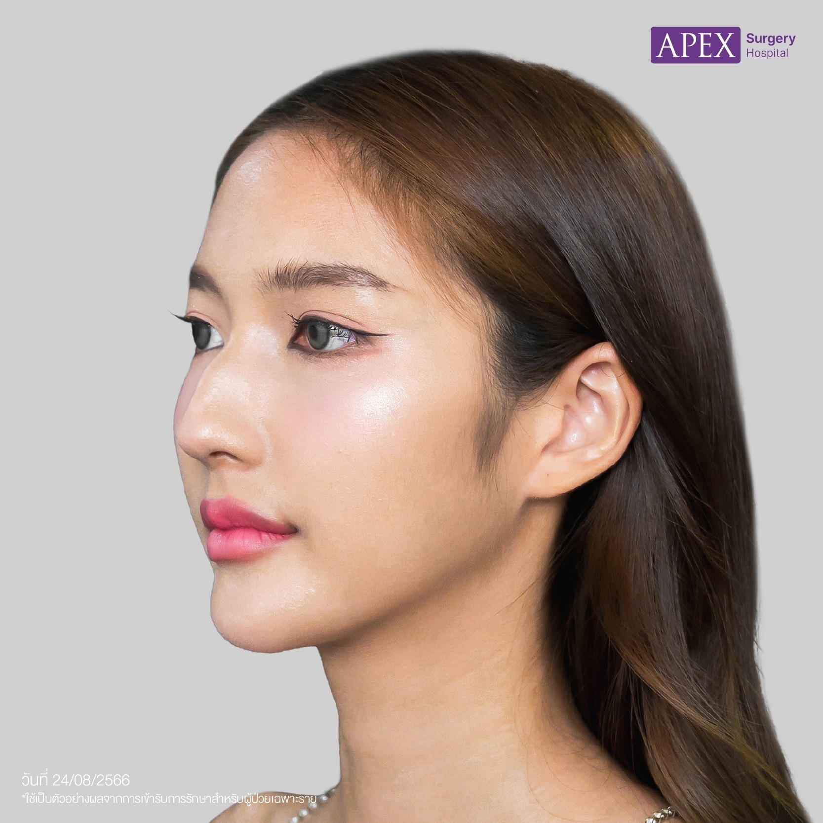 BA_Web_น้ำเพชร Open-45