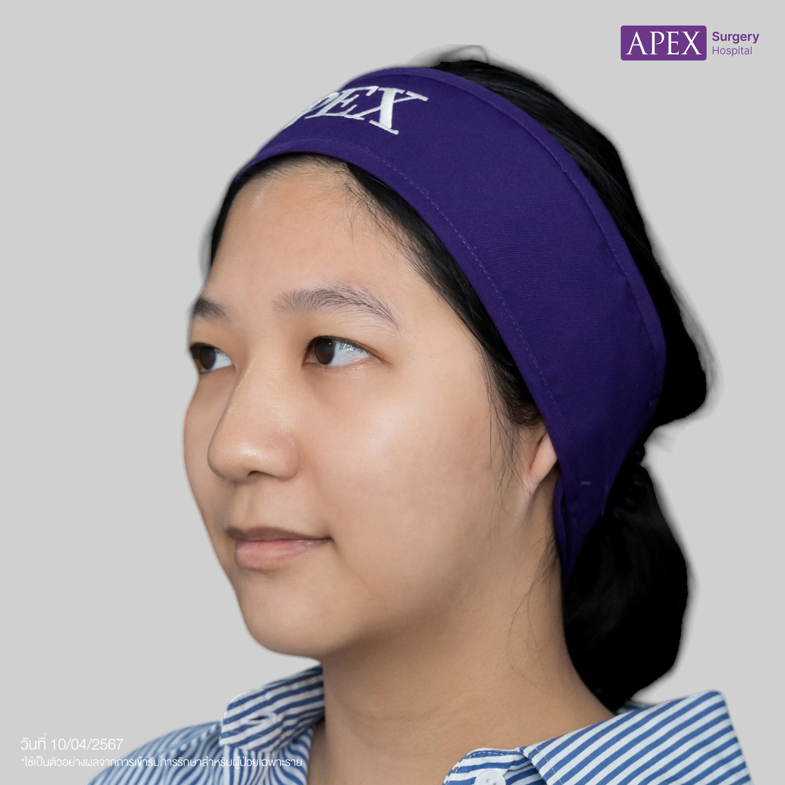 ก่อน