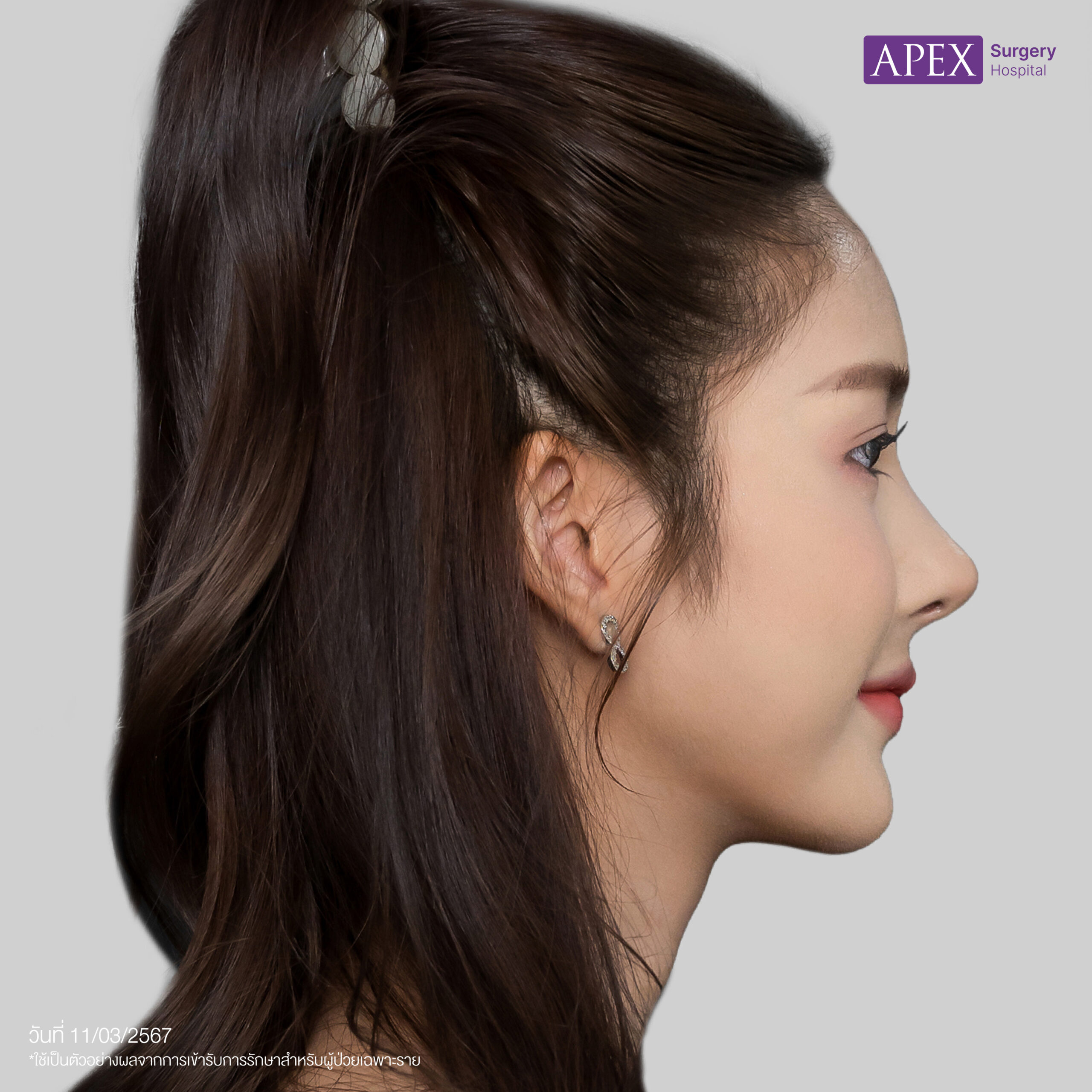 หลัง