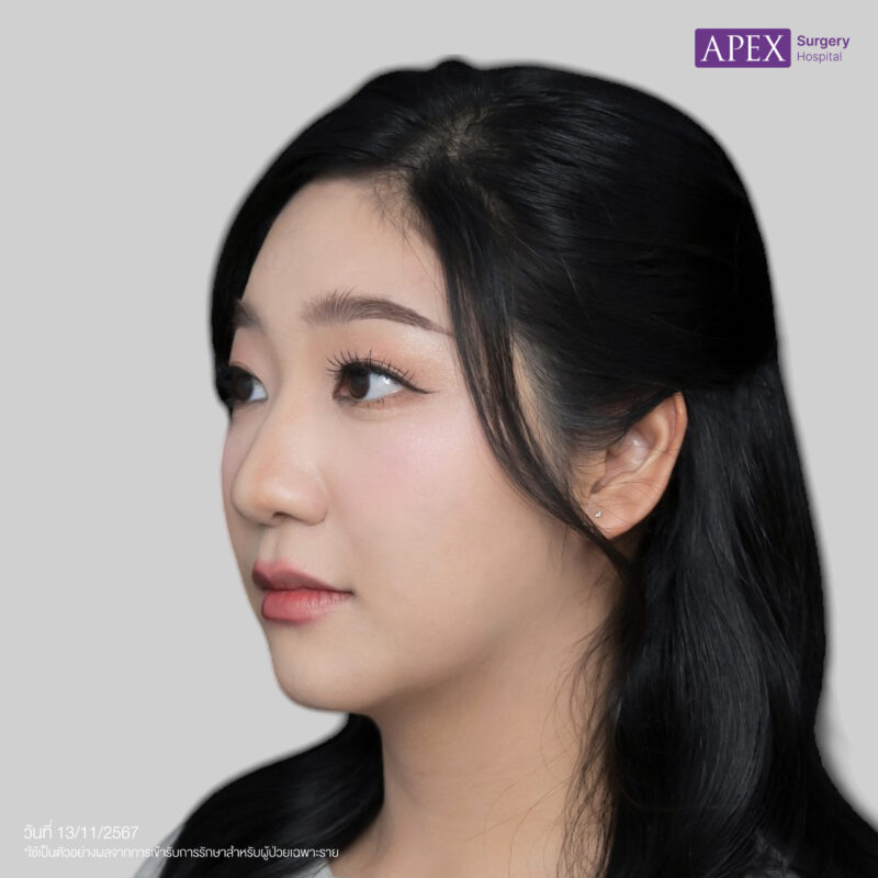 หลัง